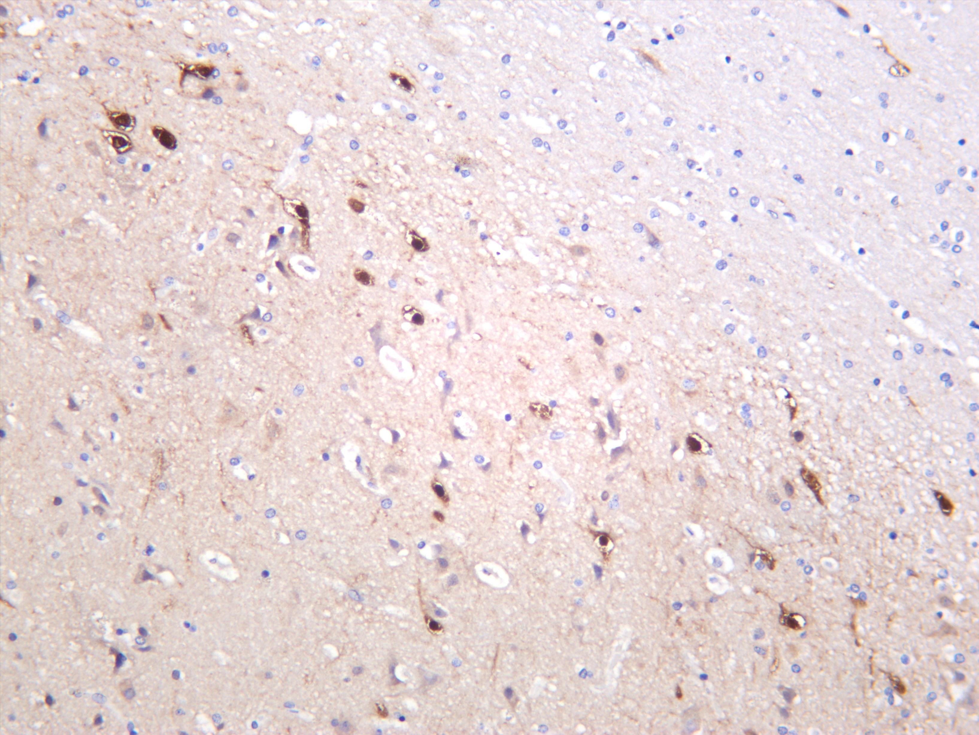 Human brain was stained with anti-PSD95 (PT0455R) rabbit antibody