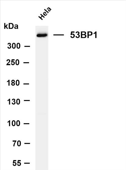 Various whole cell lysates were separated by 4-8% SDS-PAGE, and the membrane was blotted with anti-53BP1 (PT0456R) antibody. The HRP-conjugated Goat anti-Rabbit IgG(H + L) antibody was used to detect the antibody.