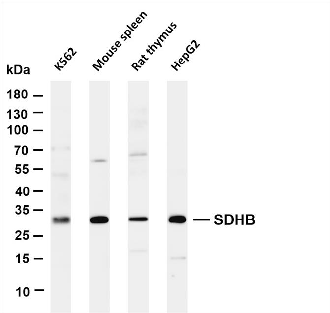 Various whole cell lysates were separated by 4-20% SDS-PAGE, and the membrane was blotted with anti-SDHB (PT0460R) antibody. The HRP-conjugated Goat anti-Rabbit IgG(H + L) antibody was used to detect the antibody.
