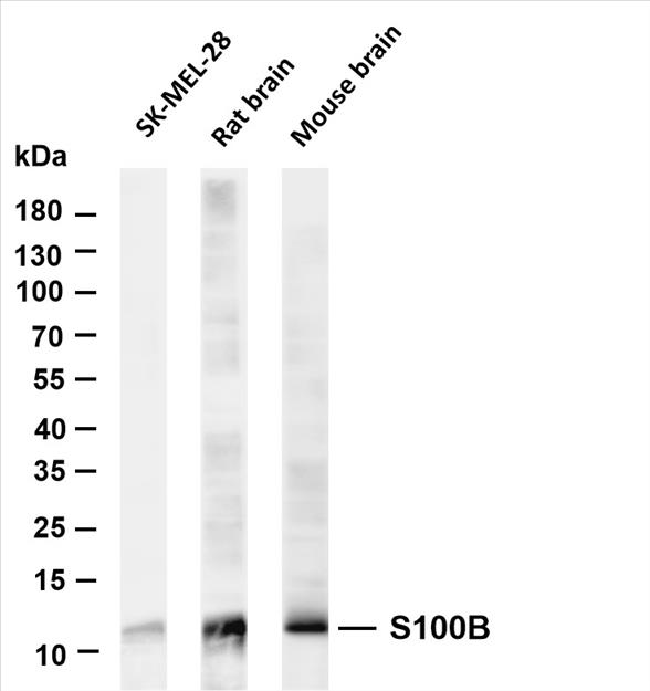 Various whole cell lysates were separated by 4-20% SDS-PAGE, and the membrane was blotted with anti-S100B (PT0461R) antibody. The HRP-conjugated Goat anti-Rabbit IgG(H + L) antibody was used to detect the antibody.