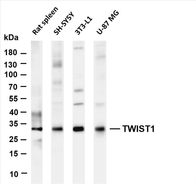 Various whole cell lysates were separated by 4-20% SDS-PAGE, and the membrane was blotted with anti-TWIST1 (PT0464R) antibody. The HRP-conjugated Goat anti-Rabbit IgG(H + L) antibody was used to detect the antibody.
