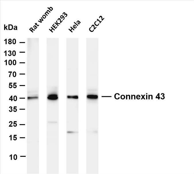 Various whole cell lysates were separated by 4-20% SDS-PAGE, and the membrane was blotted with anti-Connexin 43 (PT0467R) antibody. The HRP-conjugated Goat anti-Rabbit IgG(H + L) antibody was used to detect the antibody.