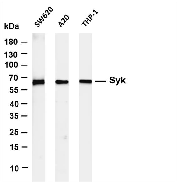 Various whole cell lysates were separated by 4-20% SDS-PAGE, and the membrane was blotted with anti-Syk (PT0468R) antibody. The HRP-conjugated Goat anti-Rabbit IgG(H + L) antibody was used to detect the antibody.