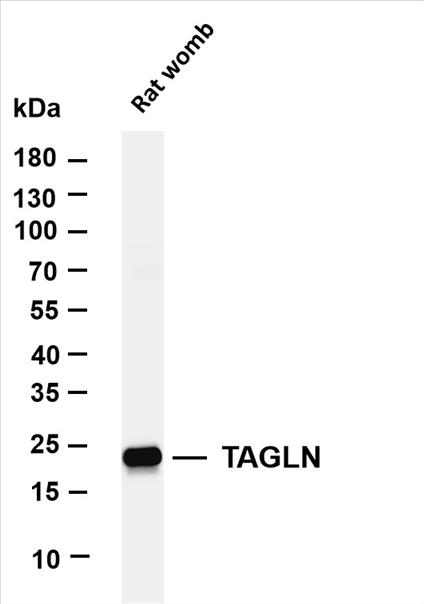 Various whole cell lysates were separated by 4-20% SDS-PAGE, and the membrane was blotted with anti-TAGLN (PT0469R) antibody. The HRP-conjugated Goat anti-Rabbit IgG(H + L) antibody was used to detect the antibody.
