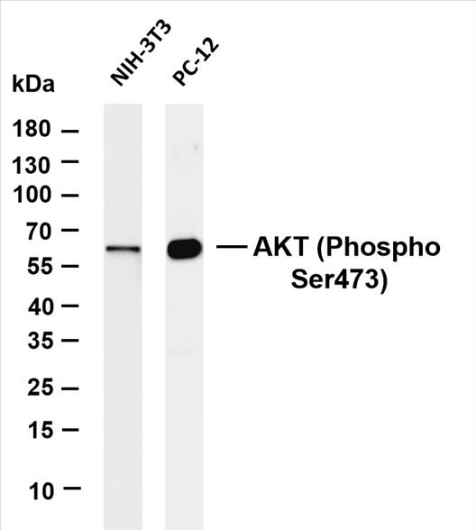 Various whole cell lysates were separated by 4-20% SDS-PAGE, and the membrane was blotted with anti-AKT (Phospho Ser473) antibody. The HRP-conjugated Goat anti-Rabbit IgG(H + L) antibody was used to detect the antibody.