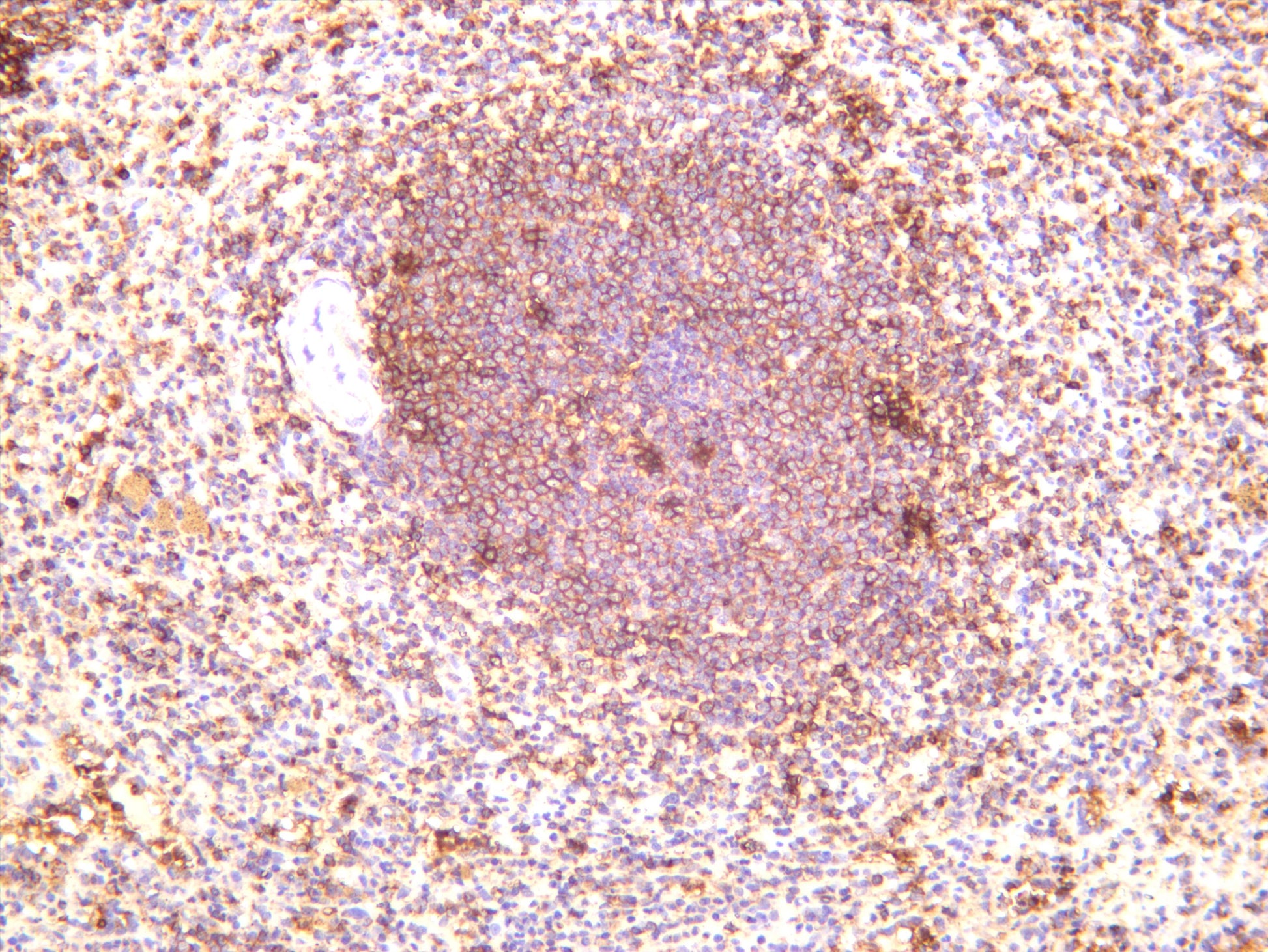Human spleen was stained with anti-CD45 (PT0471R) rabbit antibody