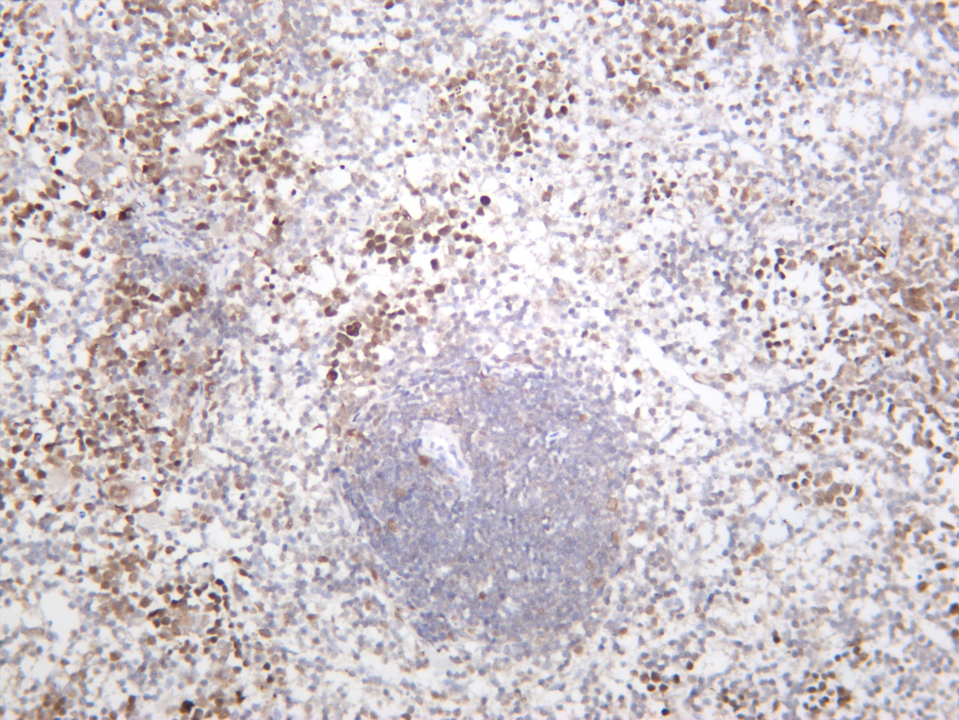 Mouse spleen was stained with anti-Chk2 (PT0474R) rabbit antibody
