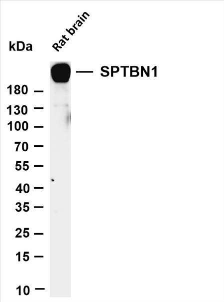 Various whole cell lysates were separated by 4-20% SDS-PAGE, and the membrane was blotted with anti-SPTBN1 (PT0477R) antibody. The HRP-conjugated Goat anti-Rabbit IgG(H + L) antibody was used to detect the antibody.