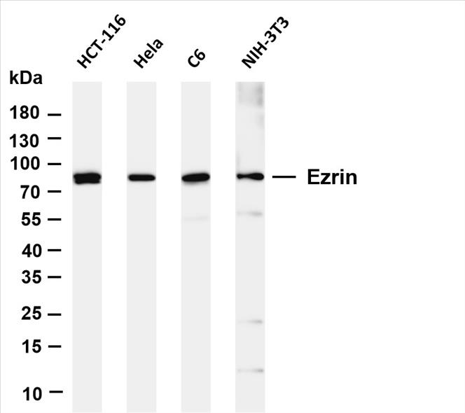 Various whole cell lysates were separated by 4-20% SDS-PAGE, and the membrane was blotted with anti-Ezrin (PT0478R) antibody. The HRP-conjugated Goat anti-Rabbit IgG(H + L) antibody was used to detect the antibody.