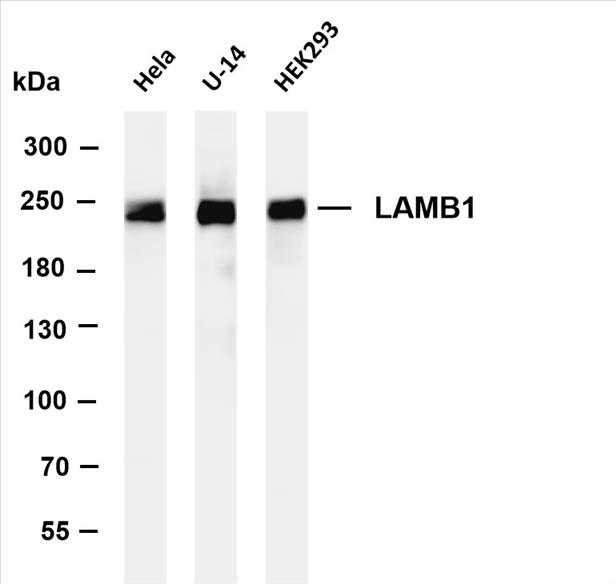 Various whole cell lysates were separated by 4-8% SDS-PAGE, and the membrane was blotted with anti-Â  LAMB1 (PT0479R) antibody. The HRP-conjugated Goat anti-Rabbit IgG(H + L) antibody was used to detect the antibody.