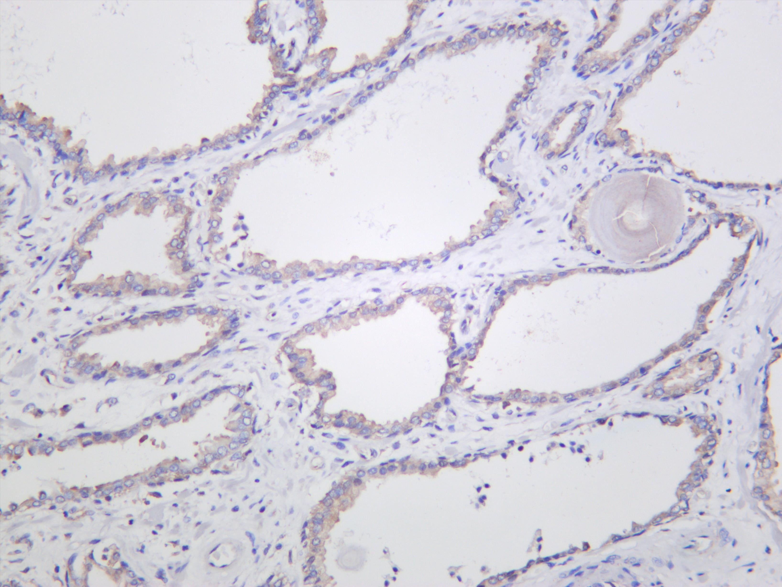Human prostate was stained with anti-Prostate Specific Membrane Antigen (PSMA) (PT0482R) rabbit antibody