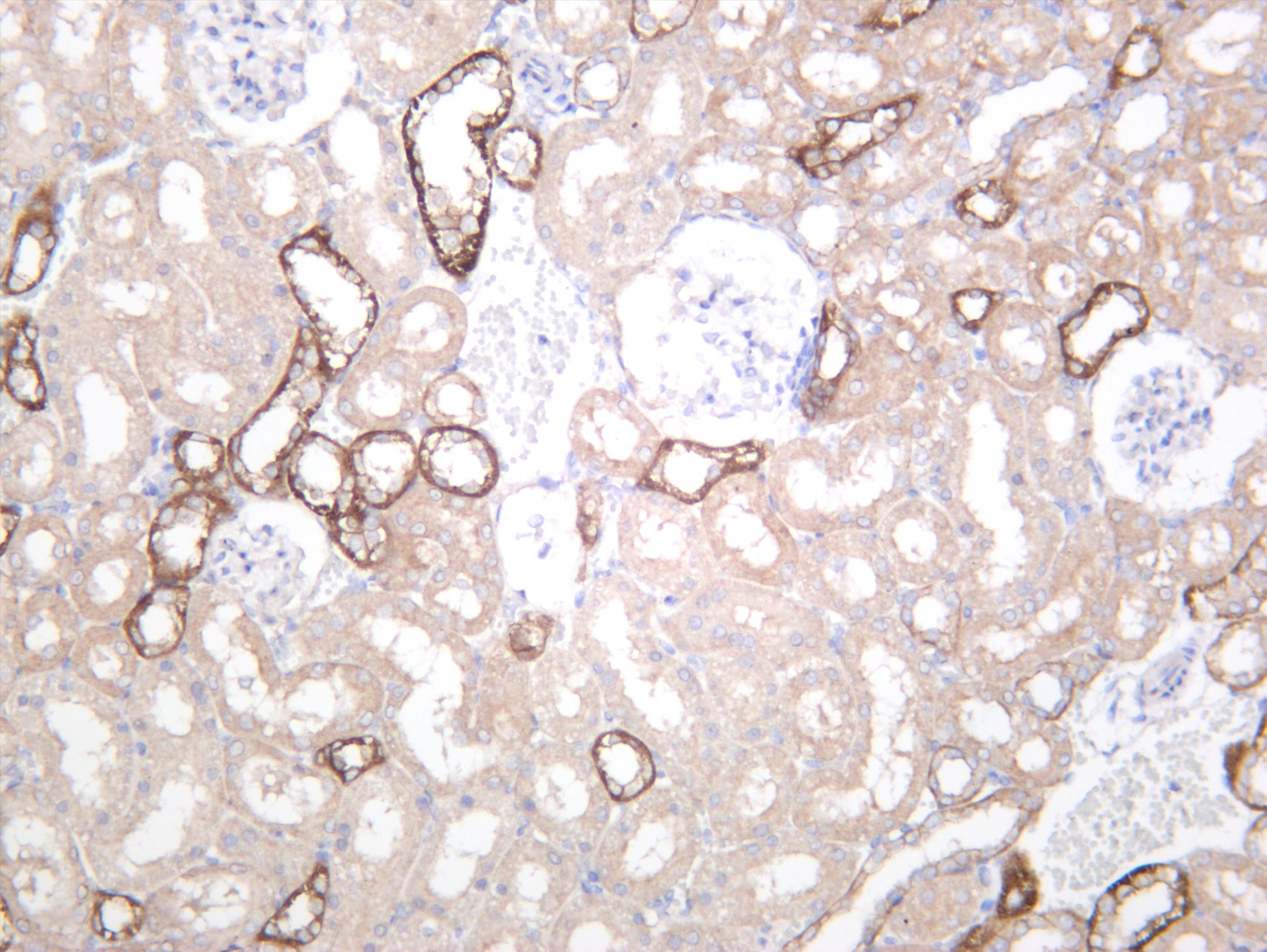 Rat kidney was stained with anti-OCLN (PT0483R) rabbit antibody