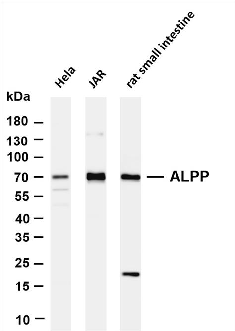 Various whole cell lysates were separated by 4-20% SDS-PAGE, and the membrane was blotted with anti-ALPP (PT0484R) antibody. The HRP-conjugated Goat anti-Rabbit IgG(H + L) antibody was used to detect the antibody.
