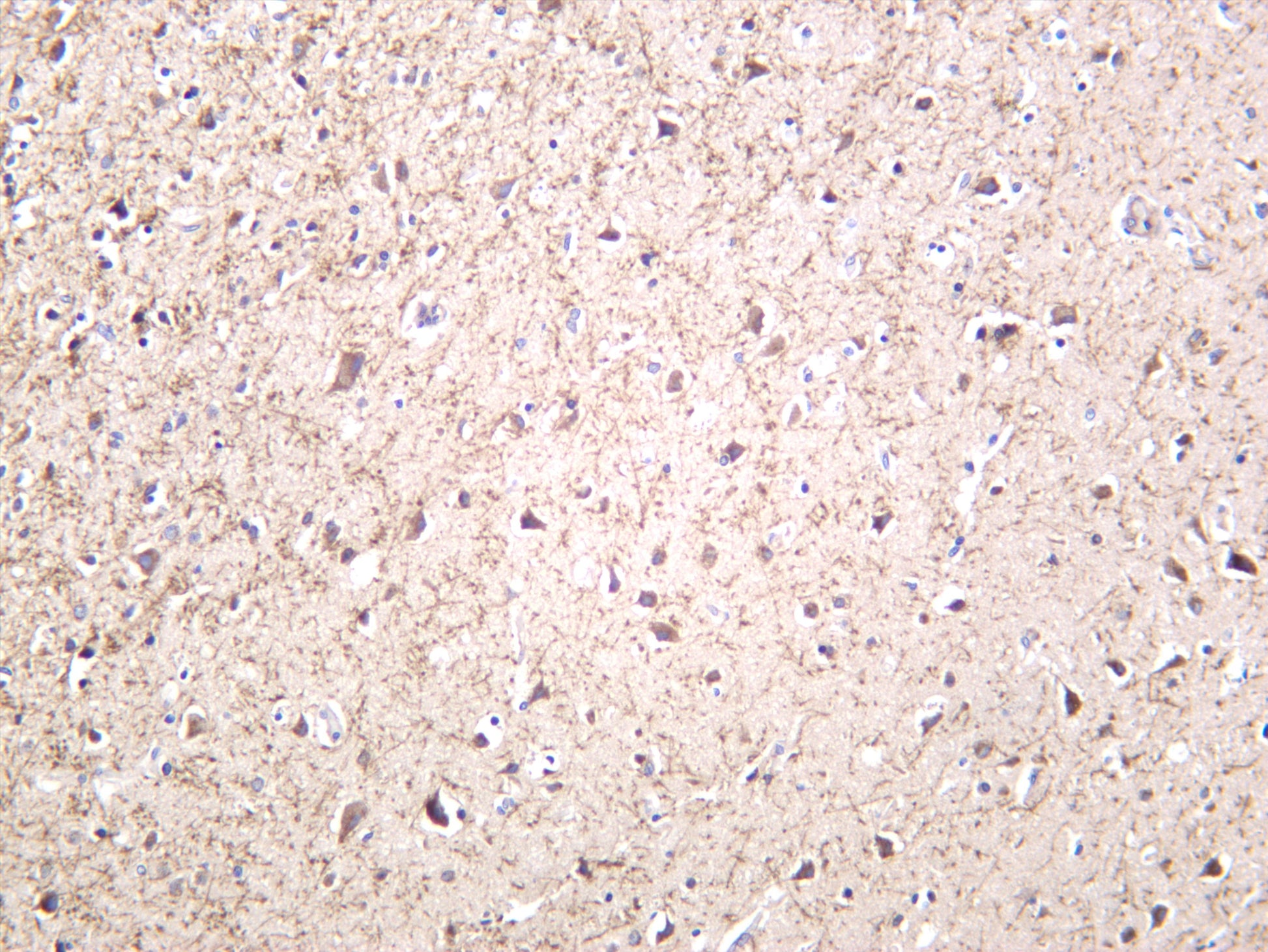 Human brain was stained with anti-Amyloid-Î² (PT0488R) rabbit antibody
