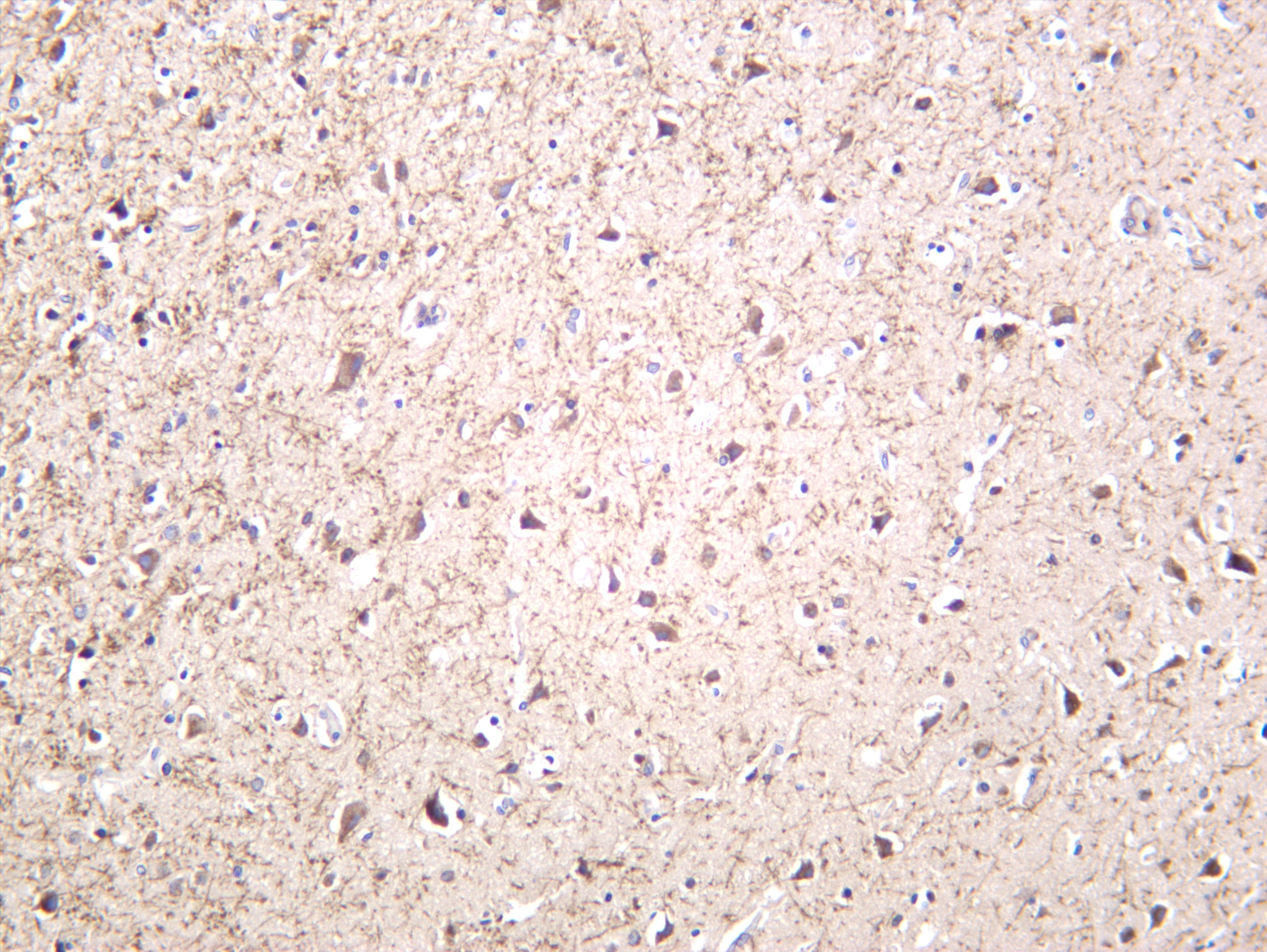 Human brain was stained with anti-Amyloid-Î² (PT0488R) rabbit antibody