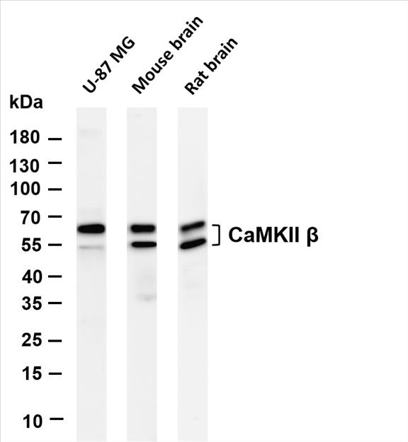 Various whole cell lysates were separated by 4-20% SDS-PAGE, and the membrane was blotted with anti-CaMKII Î² (PT0067R) antibody. The HRP-conjugated Goat anti-Rabbit IgG(H + L) antibody was used to detect the antibody.
