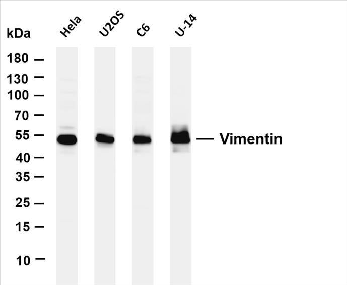 Various whole cell lysates were separated by 4-20% SDS-PAGE, and the membrane was blotted with anti-Vimentin (PT0495R) antibody. The HRP-conjugated Goat anti-Rabbit IgG(H + L) antibody was used to detect the antibody.