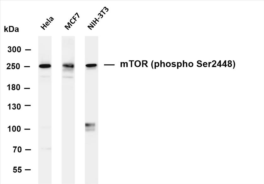 Various whole cell lysates were separated by 4-8% SDS-PAGE, and the membrane was blotted with anti-mTOR (phospho Ser2448) (PT0498R) antibody. The HRP-conjugated Goat anti-Rabbit IgG(H + L) antibody was used to detect the antibody.