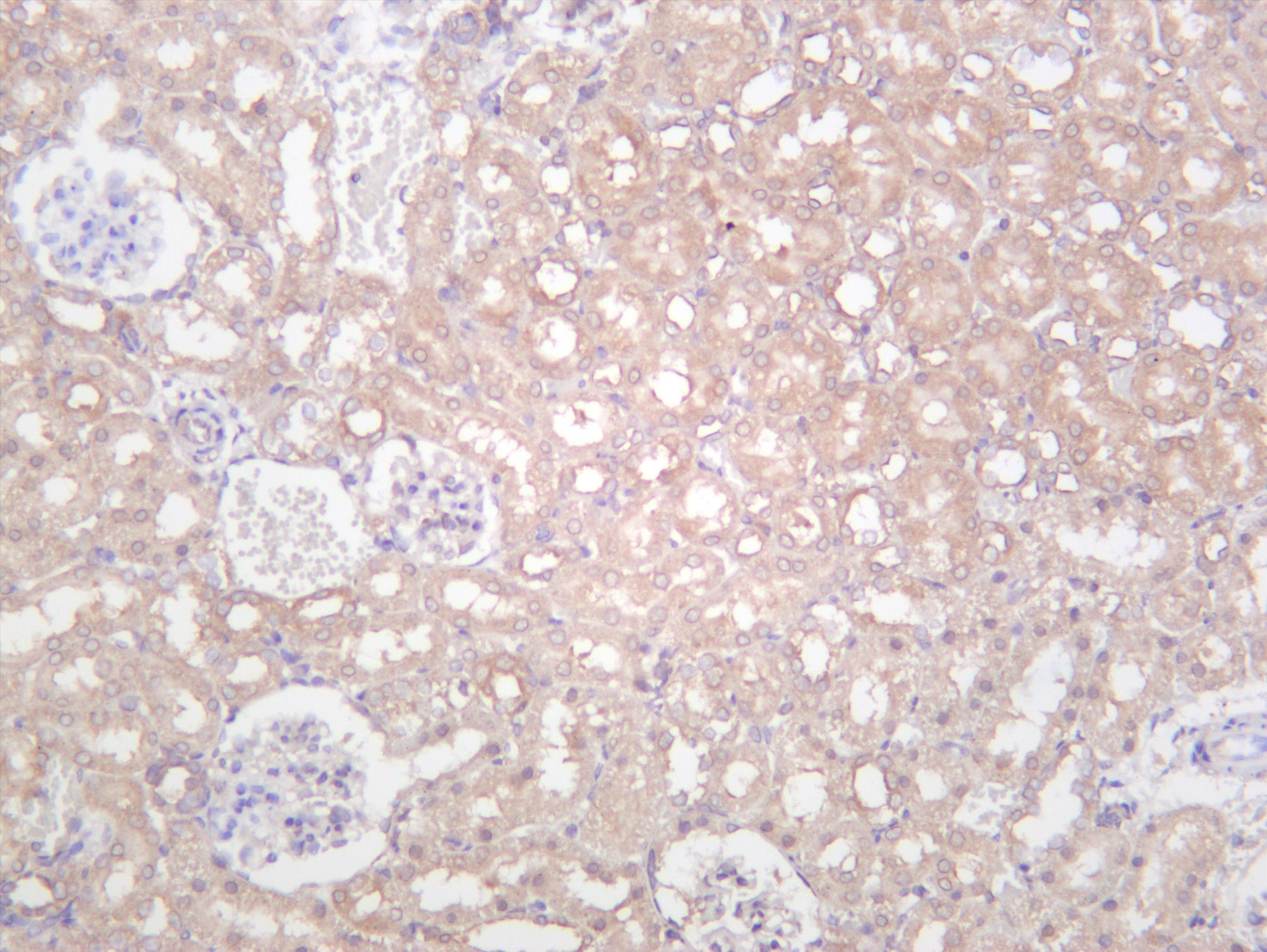 Rat kidney was stained with anti-IKK Î± (PT0501R) rabbit antibody