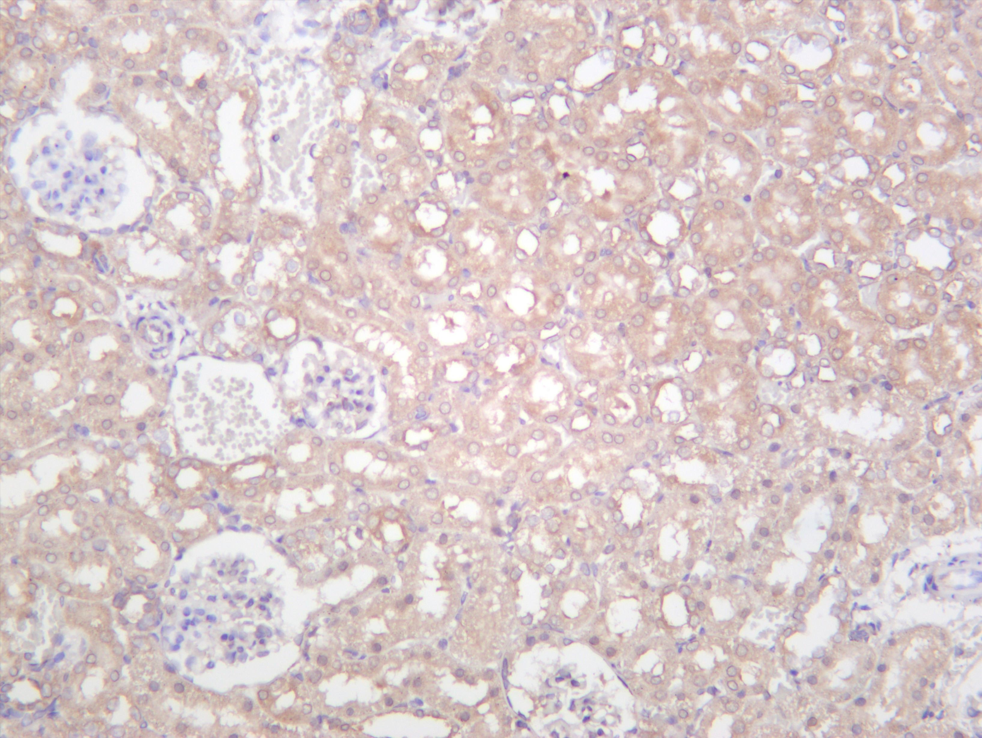 Rat kidney was stained with anti-IKK Î± (PT0501R) rabbit antibody