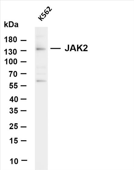Various whole cell lysates were separated by 4-20% SDS-PAGE, and the membrane was blotted with anti-JAK2 (PT0503R) antibody. The HRP-conjugated Goat anti-Rabbit IgG(H + L) antibody was used to detect the antibody.