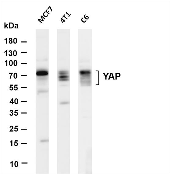 Various whole cell lysates were separated by 4-20% SDS-PAGE, and the membrane was blotted with anti-YAP (PT0504R) antibody. The HRP-conjugated Goat anti-Rabbit IgG(H + L) antibody was used to detect the antibody.