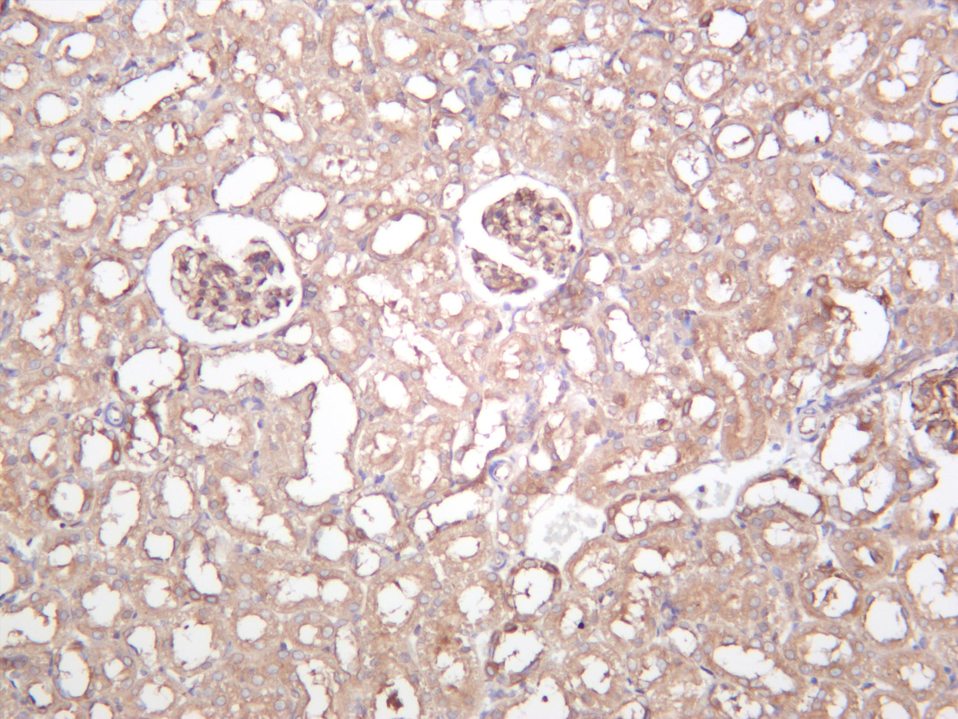 Rat kidney was stained with anti-Beclin 1 (PT0506R) rabbit antibody