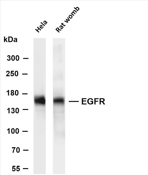 Various whole cell lysates were separated by 4-8% SDS-PAGE, and the membrane was blotted with anti-EGFR (PT0520R) antibody. The HRP-conjugated Goat anti-Rabbit IgG(H + L) antibody was used to detect the antibody.
