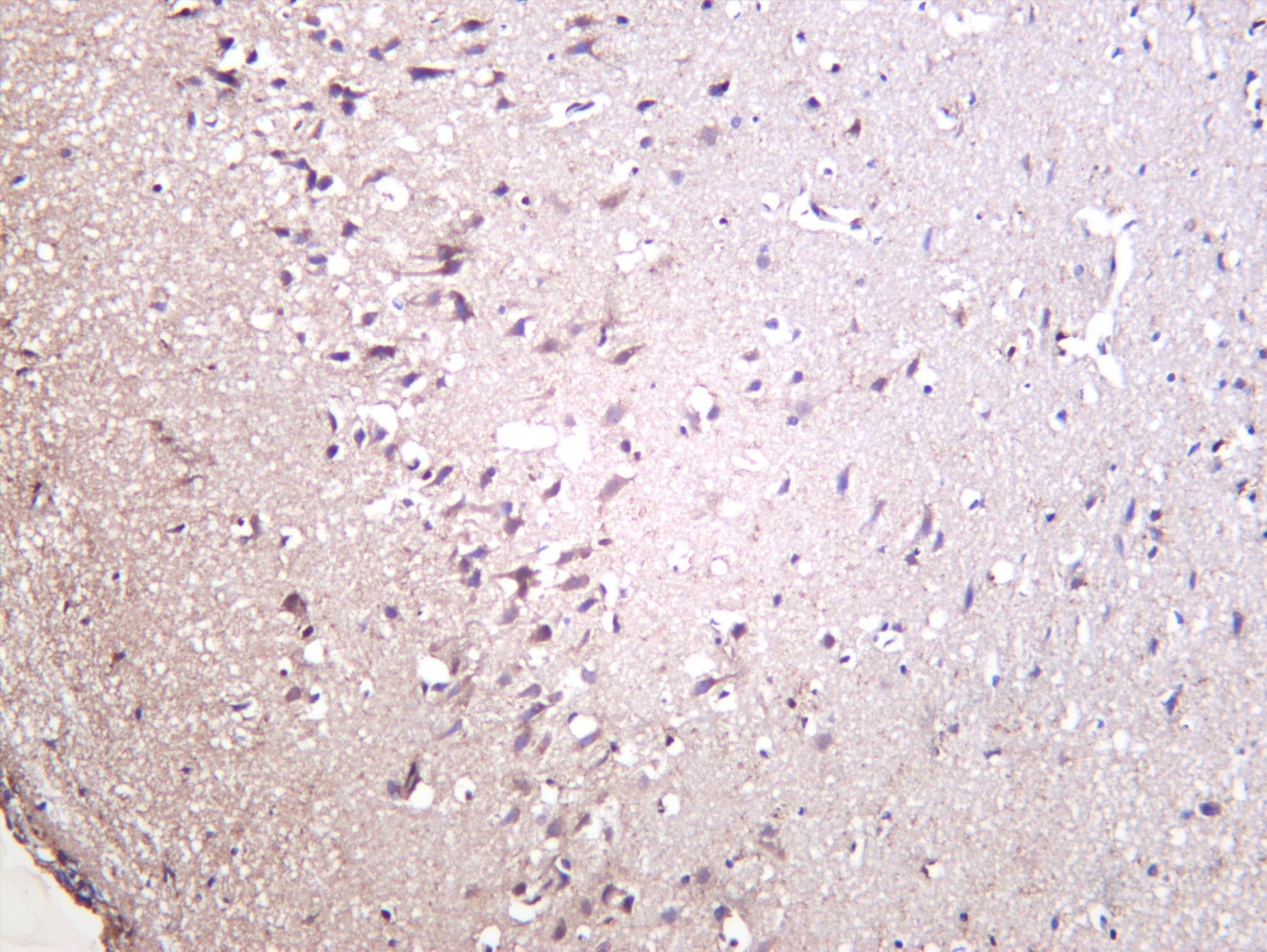 Rat brain was stained with anti-VEGFA (PT0522R) rabbit antibody