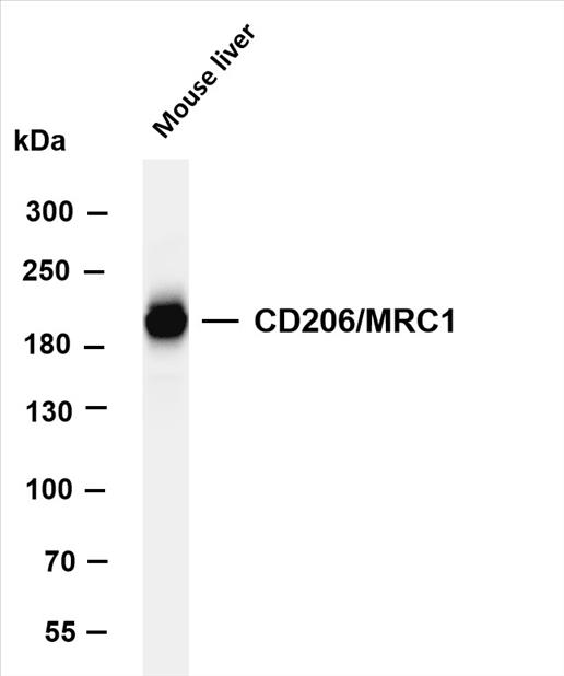 Various whole cell lysates were separated by 4-8% SDS-PAGE, and the membrane was blotted with anti-CD206/MRC1 (PT0527R) antibody. The HRP-conjugated Goat anti-Rabbit IgG(H + L) antibody was used to detect the antibody.