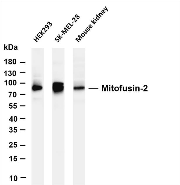 Various whole cell lysates were separated by 4-20% SDS-PAGE, and the membrane was blotted with anti-Mitofusin-2 (PT0529R) antibody. The HRP-conjugated Goat anti-Rabbit IgG(H + L) antibody was used to detect the antibody.
