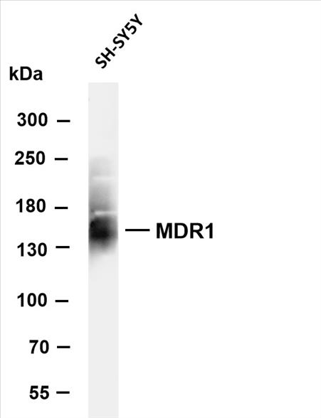 Various whole cell lysates were separated by 4-8% SDS-PAGE, and the membrane was blotted with anti-MDR1 (PT0531R) antibody. The HRP-conjugated Goat anti-Rabbit IgG(H + L) antibody was used to detect the antibody.