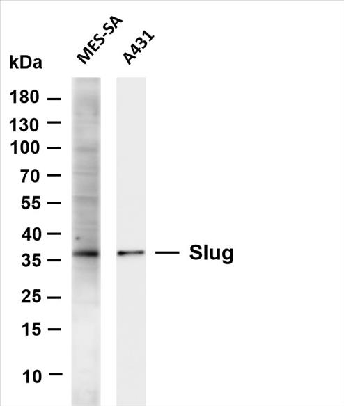 Various whole cell lysates were separated by 4-20% SDS-PAGE, and the membrane was blotted with anti-Slug (PT0536R) antibody. The HRP-conjugated Goat anti-Rabbit IgG(H + L) antibody was used to detect the antibody.