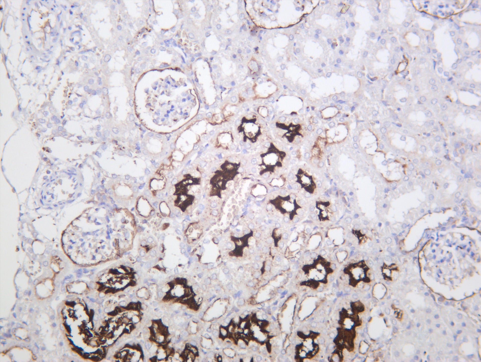 Rat kidney was stained with anti-CD10 (PT0537R) rabbit antibody