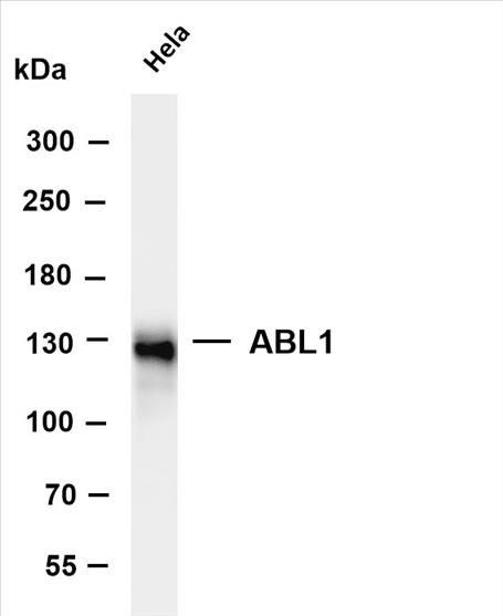Various whole cell lysates were separated by 4-8% SDS-PAGE, and the membrane was blotted with anti-ABL1 (PT0539R) antibody. The HRP-conjugated Goat anti-Rabbit IgG(H + L) antibody was used to detect the antibody.