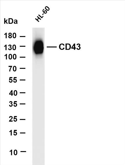 Various whole cell lysates were separated by 4-20% SDS-PAGE, and the membrane was blotted with anti-CD43 (PT0540R) antibody. The HRP-conjugated Goat anti-Rabbit IgG(H + L) antibody was used to detect the antibody.