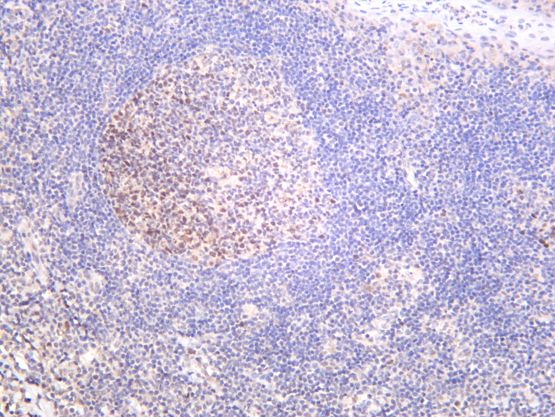 Human tonsil was stained with anti-Dnmt1 (PT0542R) rabbit antibody