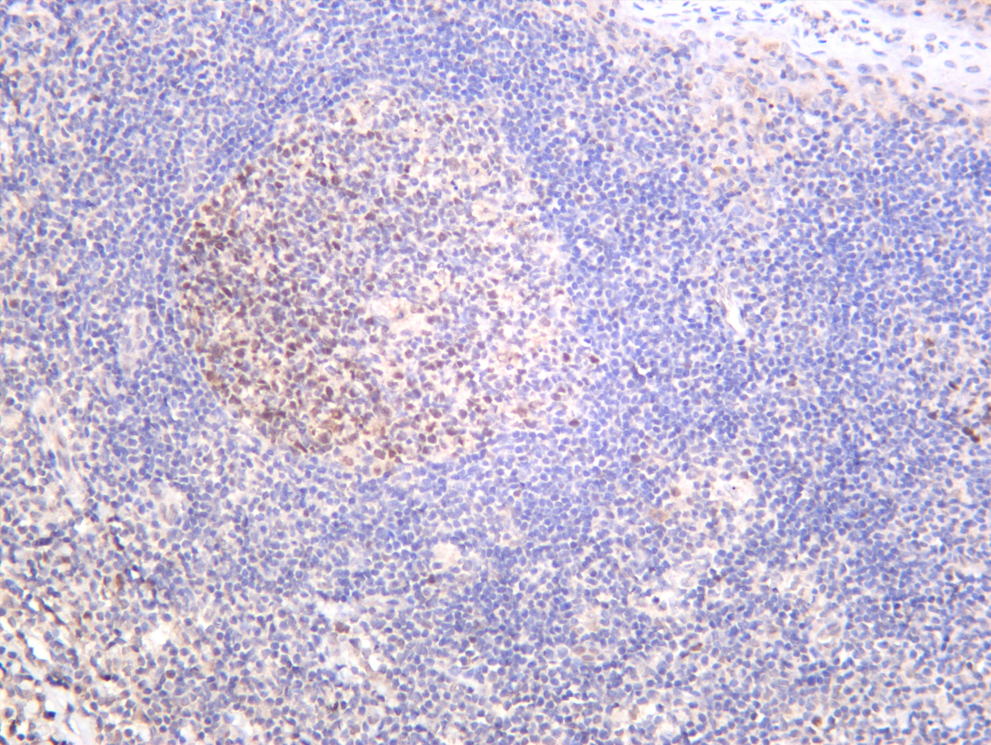 Human tonsil was stained with anti-Dnmt1 (PT0542R) rabbit antibody