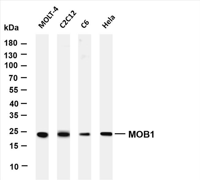 Various whole cell lysates were separated by 4-20% SDS-PAGE, and the membrane was blotted with anti-MOB1 (PT0546R) antibody. The HRP-conjugated Goat anti-Rabbit IgG(H + L) antibody was used to detect the antibody.