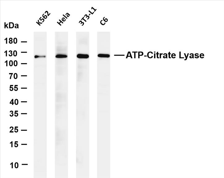 Various whole cell lysates were separated by 4-20% SDS-PAGE, and the membrane was blotted with anti-ATP-Citrate Lyase (PT0552R) antibody. The HRP-conjugated Goat anti-Rabbit IgG(H + L) antibody was used to detect the antibody.