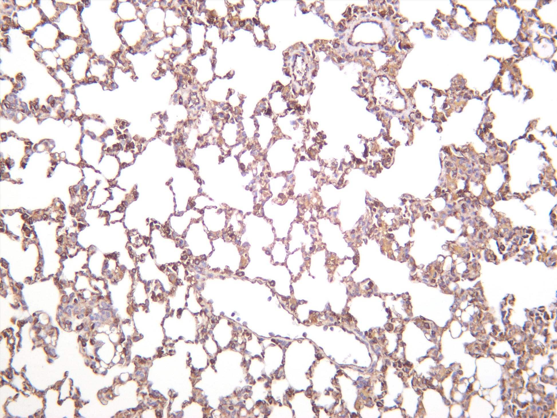 Mouse lung was stained with anti-VE Cadherin (PT0553R) rabbit antibody
