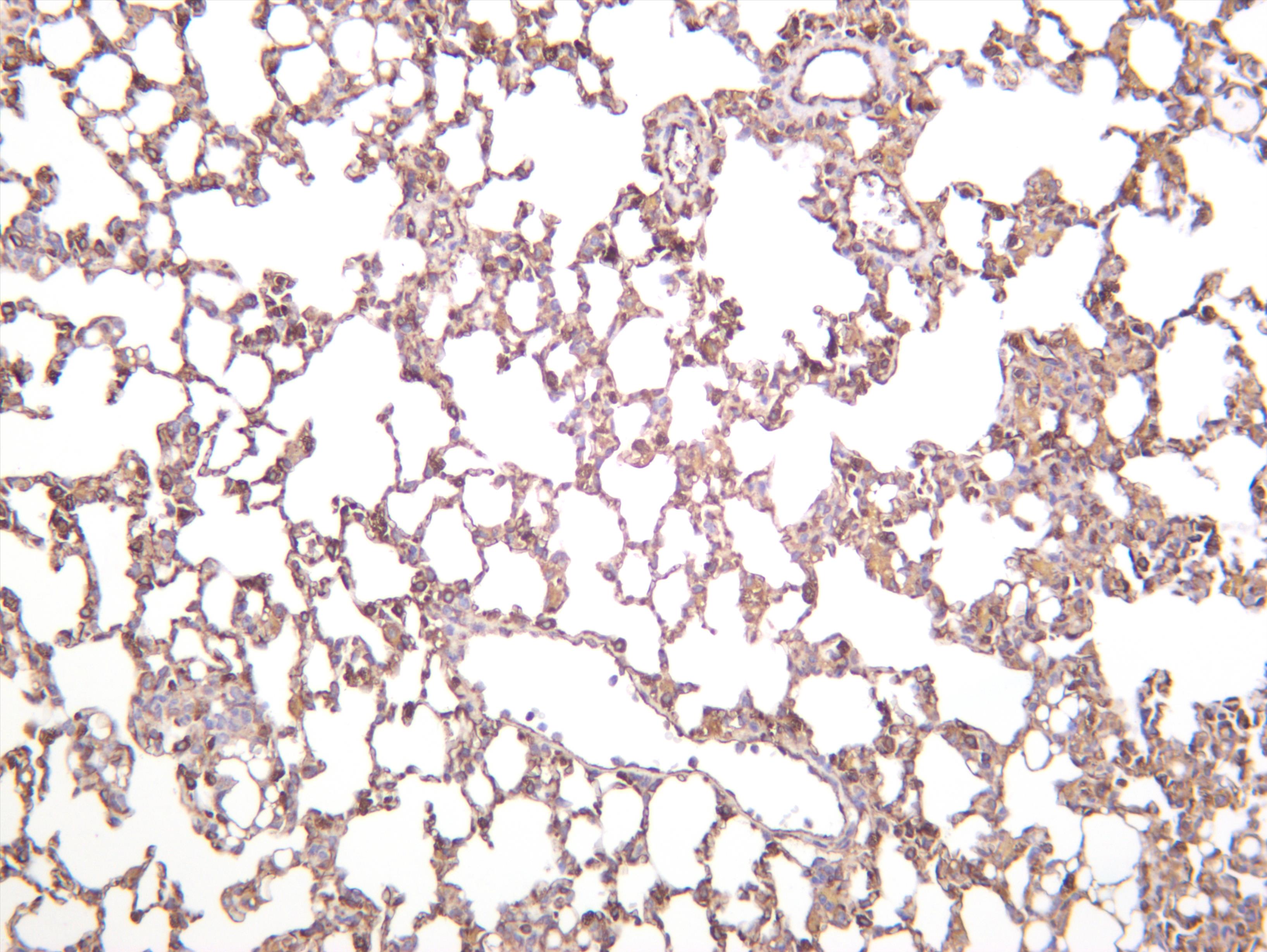 Mouse lung was stained with anti-VE Cadherin (PT0553R) rabbit antibody