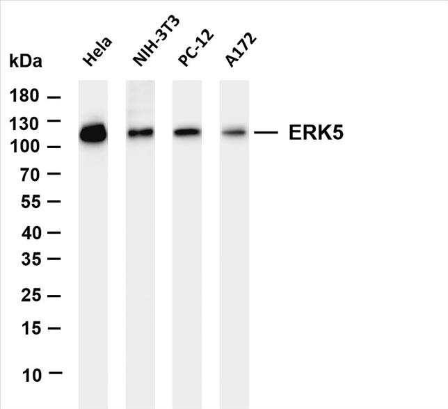 Various whole cell lysates were separated by 4-20% SDS-PAGE, and the membrane was blotted with anti-ERK5 (PT0556R) antibody. The HRP-conjugated Goat anti-Rabbit IgG(H + L) antibody was used to detect the antibody.