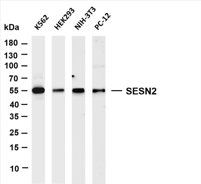 Various whole cell lysates were separated by 4-20% SDS-PAGE, and the membrane was blotted with anti-SESN2 (PT0570R) antibody. The HRP-conjugated Goat anti-Rabbit IgG(H + L) antibody was used to detect the antibody.