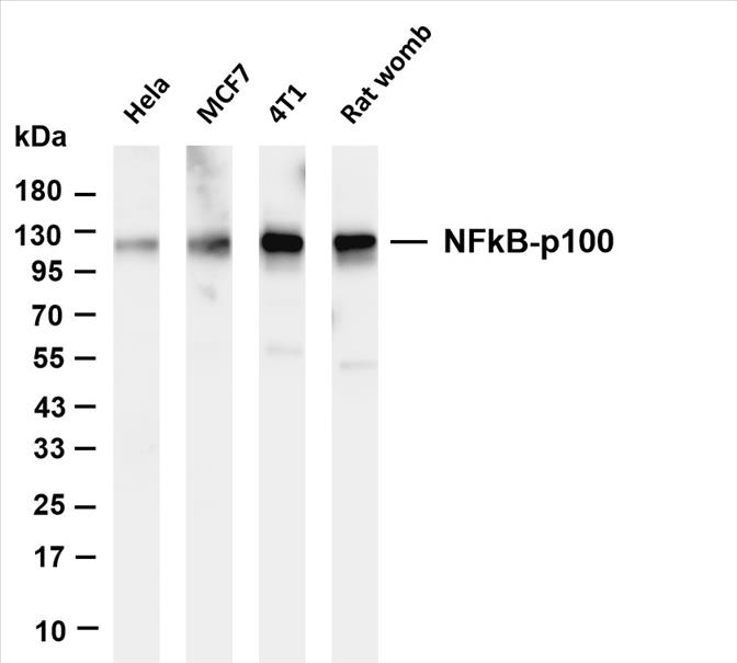 Various whole cell lysates were separated by 4-20% SDS-PAGE, and the membrane was blotted with anti-NFkB p100 (PT0571R) antibody. The HRP-conjugated Goat anti-Rabbit IgG(H + L) antibody was used to detect the antibody.
