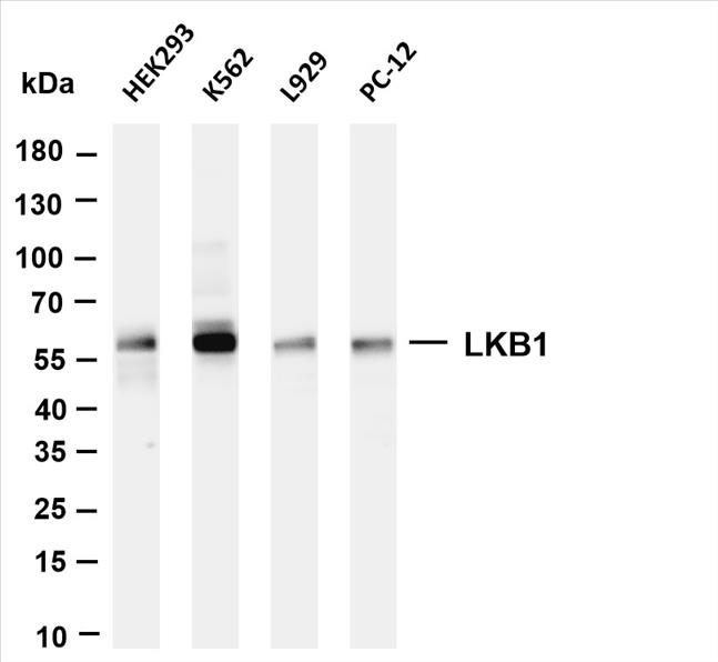 Various whole cell lysates were separated by 4-20% SDS-PAGE, and the membrane was blotted with anti-LKB1 (PT0574R) antibody. The HRP-conjugated Goat anti-Rabbit IgG(H + L) antibody was used to detect the antibody.