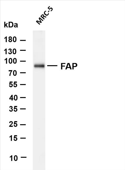 Various whole cell lysates were separated by 10% SDS-PAGE, and the membrane was blotted with anti-FAP (PT0578R) antibody. The HRP-conjugated Goat anti-Rabbit IgG(H + L) antibody was used to detect the antibody.