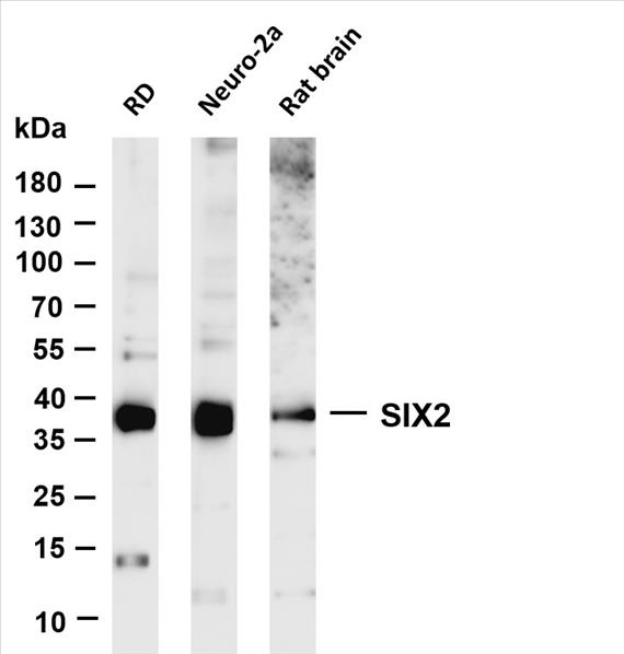 Various whole cell lysates were separated by 4-20% SDS-PAGE, and the membrane was blotted with anti-SIX2 (PT0580R) antibody. The HRP-conjugated Goat anti-Rabbit IgG(H + L) antibody was used to detect the antibody.