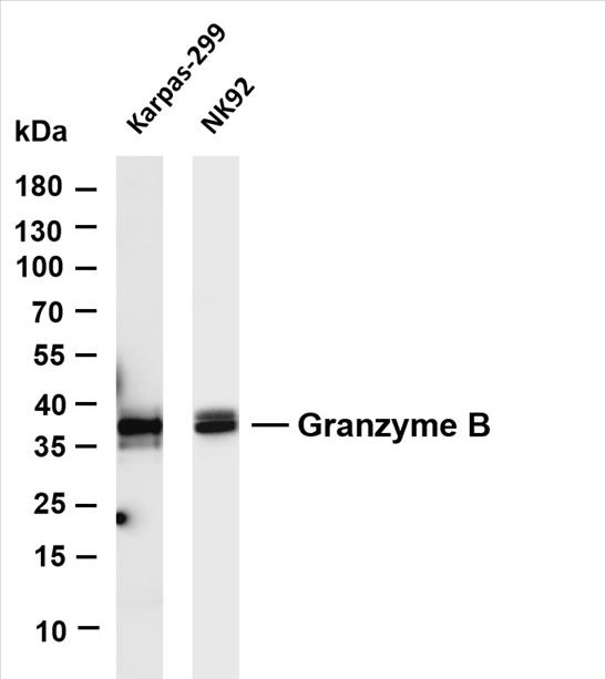 Various whole cell lysates were separated by 4-20% SDS-PAGE, and the membrane was blotted with anti-Granzyme B (PT0581R) antibody. The HRP-conjugated Goat anti-Rabbit IgG(H + L) antibody was used to detect the antibody.