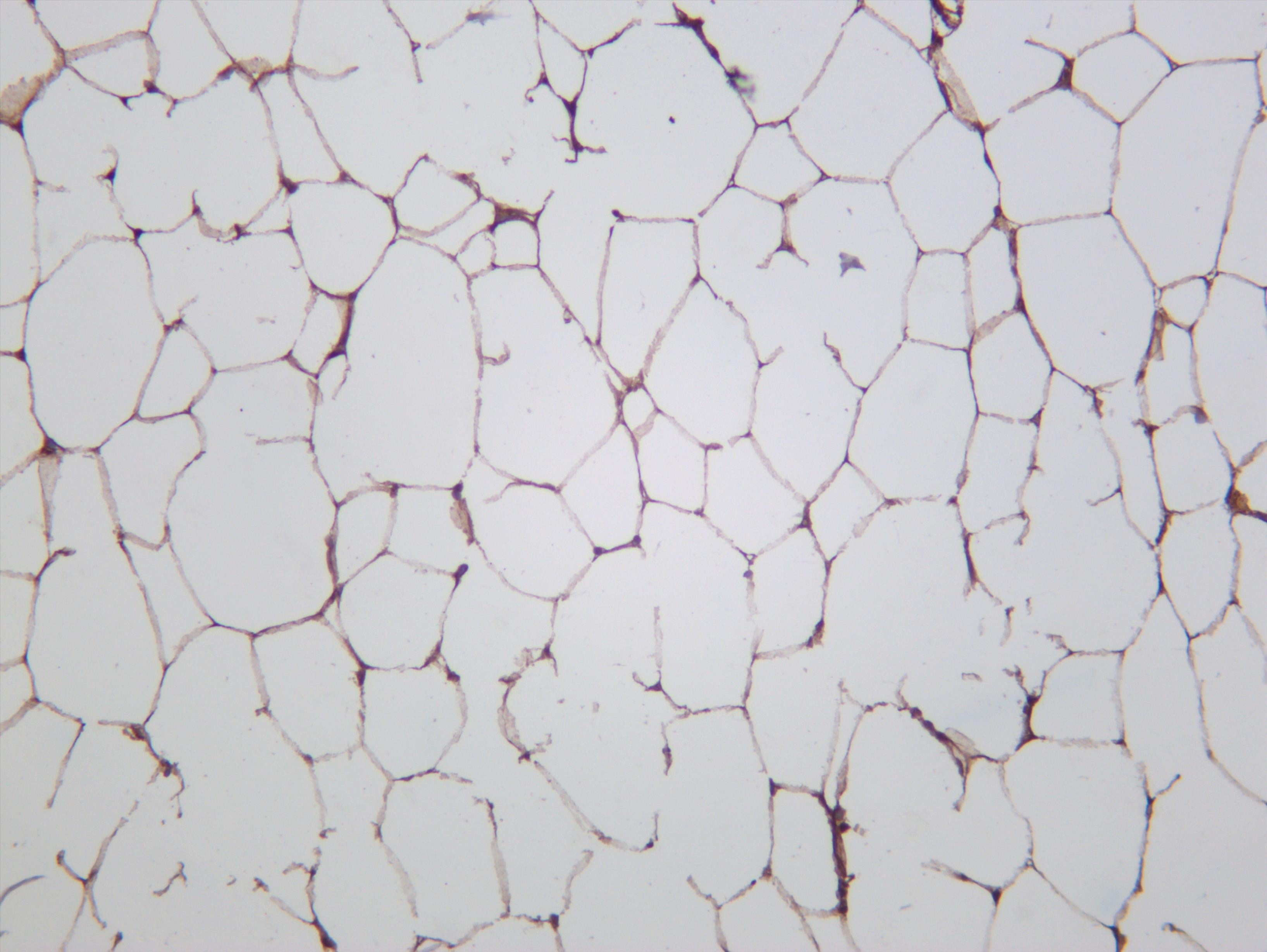 Rat white adipose was stained with anti-ATGL (PT0586R) rabbit antibody